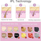 IPL Hair Removal